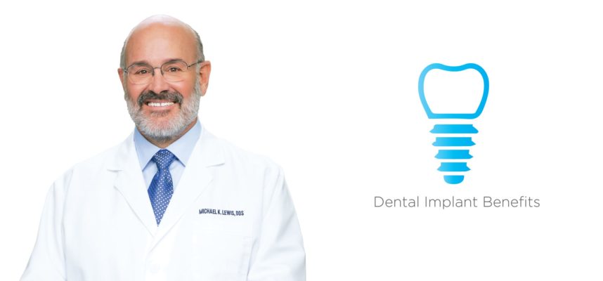 What are the benefits of dental implants in Monterey, CA?